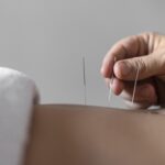 Punción Seca en Villaverde | Sanilux